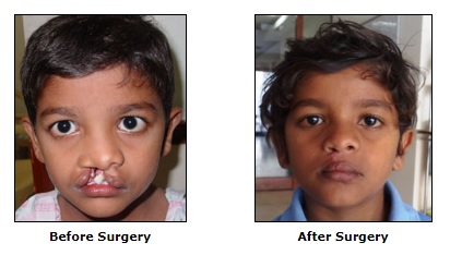 Reconstructive Surgery, Congenital deformities Surgery