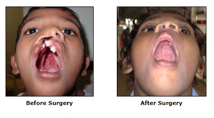 Reconstructive Surgery, Congenital Deformities Surgery