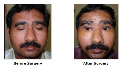 Reconstructive Surgery, Congenital Deformities Surgery