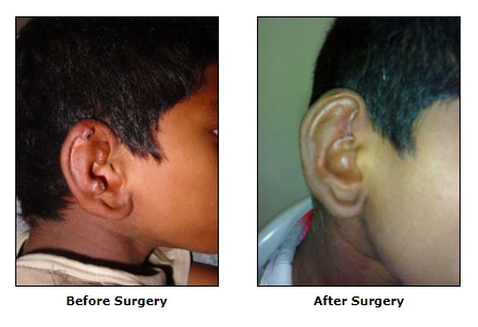 Reconstructive Surgery, Congenital Deformities Surgery, Vascular Malformations Surgery
